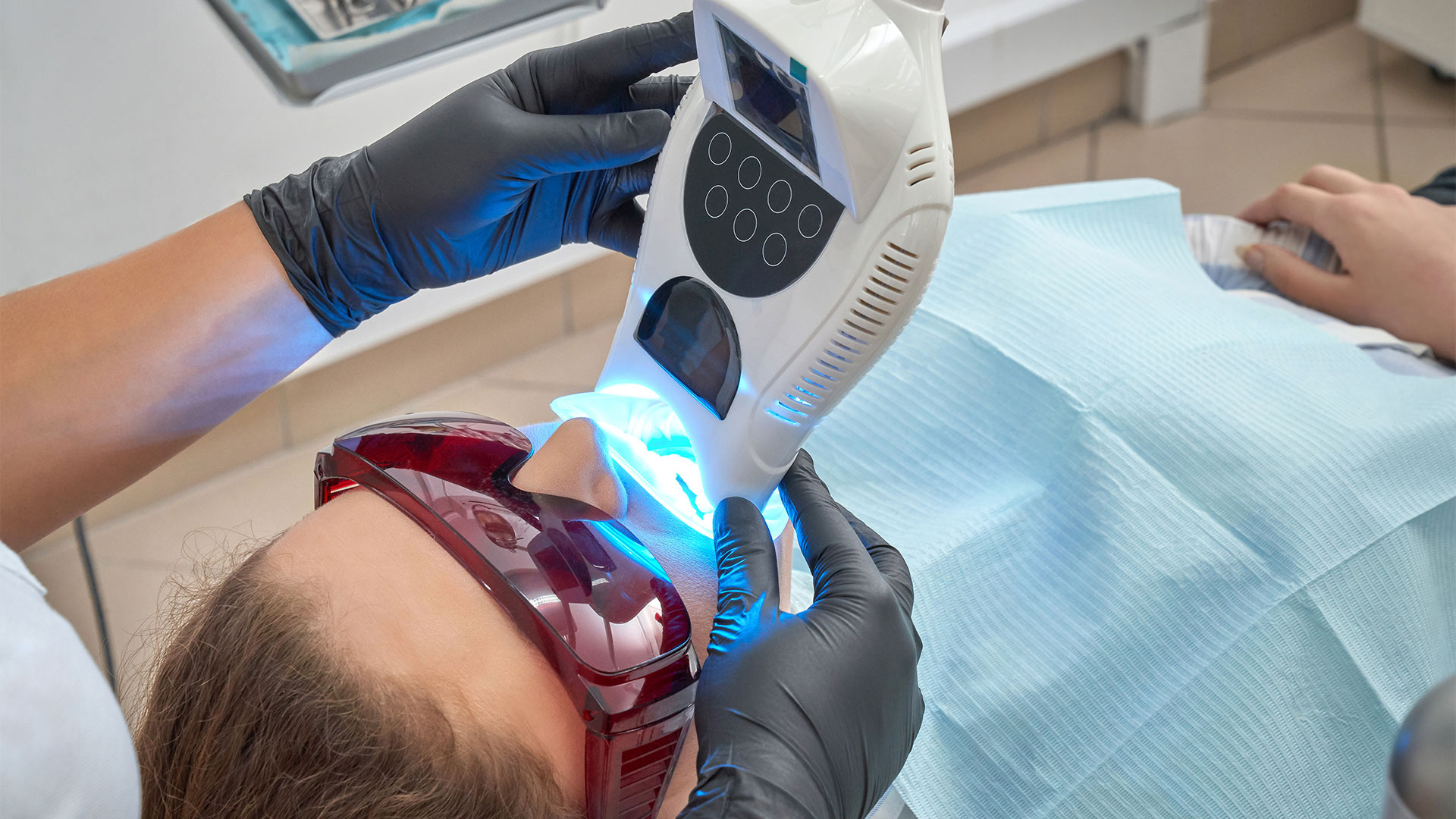 オフィスホワイトニング